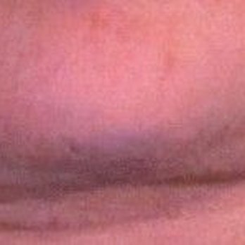Anil Shah, MD, FACS - Plastic Surgeons Near Me - Chicago, Illinois Anil Shah, MD, FACS - Plastic Surgeons Near Me - Chicago, Illinois