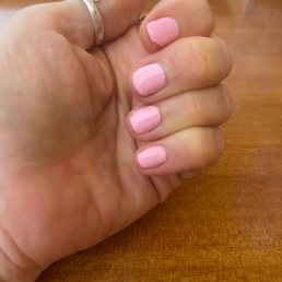 Chopped nails and bleeding cuticles Chopped nails and bleeding cuticles
