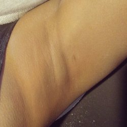 The Sugar Parlor - Underarm sugaring resulting in ultra smooth skin. No redness or swelling.