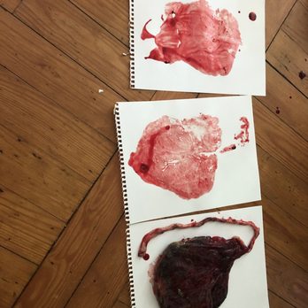 Wildflower Midwifery - Placenta print - Midwives Near Me Wildflower Midwifery - Placenta print - Midwives Near Me