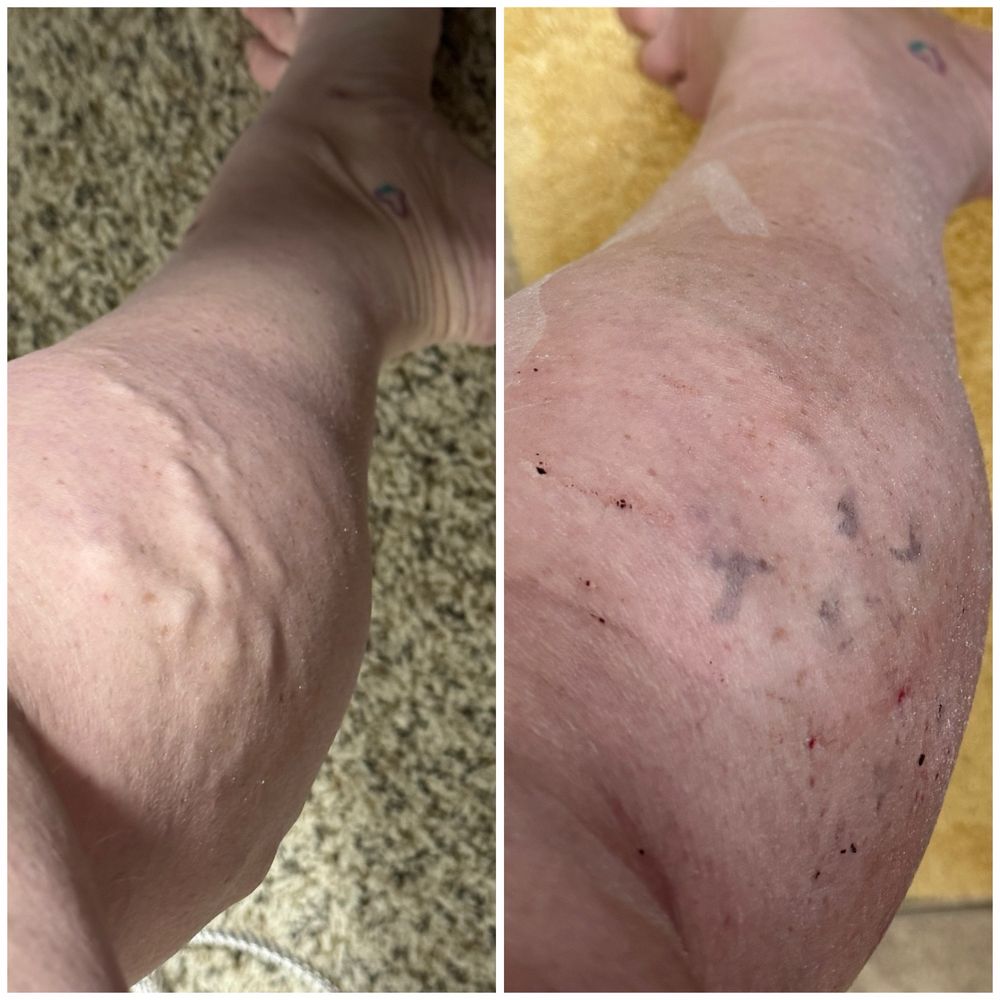 Albert Vein Institute - patient advocate in Colorado Springs, CO