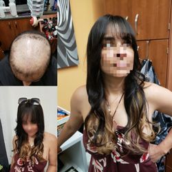 Alopecia Confidence Hair - Beautiful lady's bio hair system and  tape-in extensions