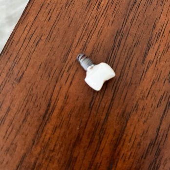 Supreme Dental Clinic - The first "titanium" implant where the screw broke in my jawbone - Cosmetic Dentists Near Me - Los Algodones, BCN Supreme Dental Clinic - The first "titanium" implant where the screw broke in my jawbone - Cosmetic Dentists Near Me - Los Algodones, BCN