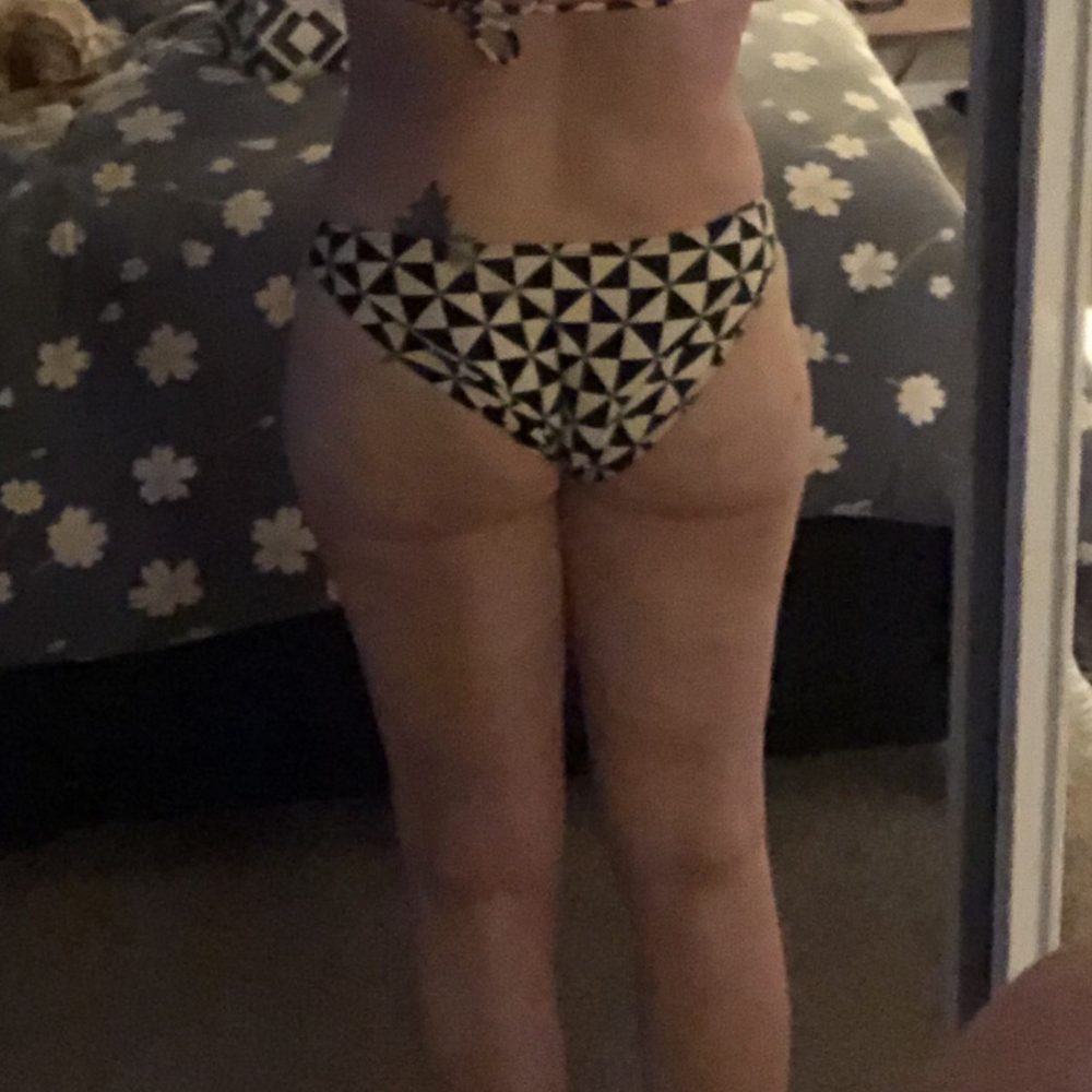 Dr. Marc-Antoine Chabrier - Butt too flat and droopy. Not enough fat on me to do it right. - Cosmetic Surgeons Near Me - Tijuana, BCN