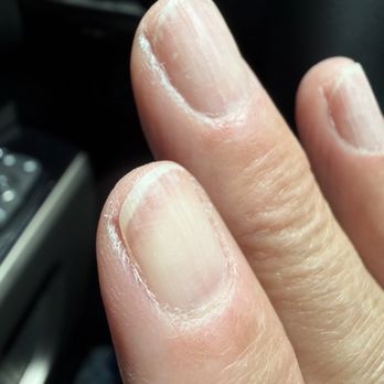 Cali Spa - These are after pics of my manicure, horrible - Day Spas Near Me - Fort Wayne, Indiana Cali Spa - These are after pics of my manicure, horrible - Day Spas Near Me - Fort Wayne, Indiana
