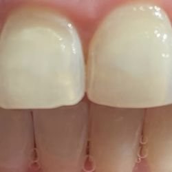 Gerardo L Beauchamp, DDS - Beauchamp Dental