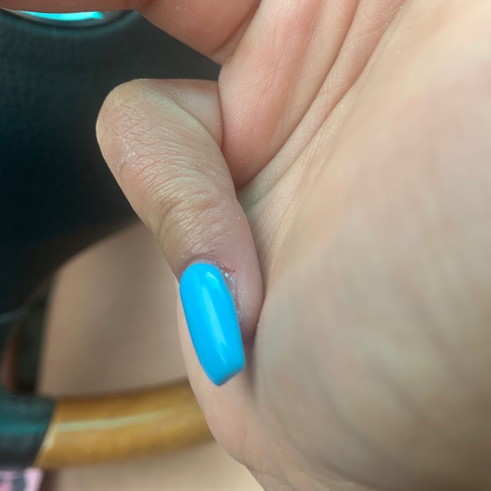 The Elegant Nails and Spa - My cuticles bled. - Nail Salons Near Me - Parker, Colorado The Elegant Nails and Spa - My cuticles bled. - Nail Salons Near Me - Parker, Colorado