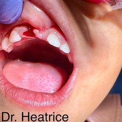 Bloomy's Pediatric Dentistry - Dr Heatrice Pediatric Dentistry