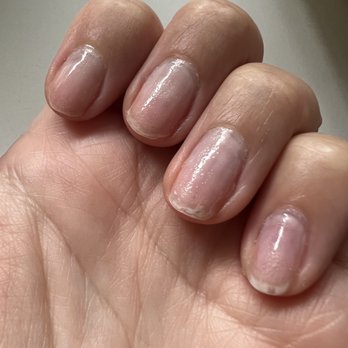 M2 Nail Lounge - This is the state of my nails now after the crappy manicure and the harsh drill bit use. Notice the weird texture. - Nail Salons Near Me - Alhambra , California M2 Nail Lounge - This is the state of my nails now after the crappy manicure and the harsh drill bit use. Notice the weird texture. - Nail Salons Near Me - Alhambra , California
