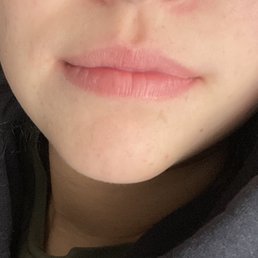 before before