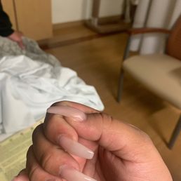 Bulky, uneven, horrible shape, painful and now my fingers are swollen too. Bulky, uneven, horrible shape, painful and now my fingers are swollen too.