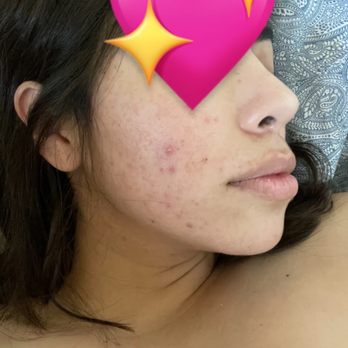 Carla Bonilla Beauty - May 30, 2021 (2 weeks after facial) following adjusted routine @ home - Skin Care Near Me - Glendale, California