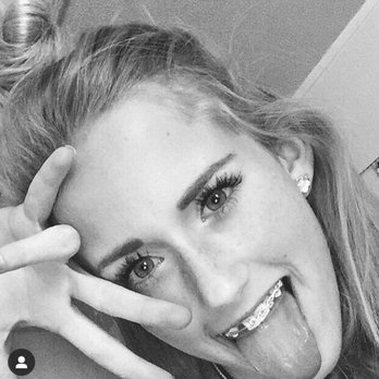 Smile Creations - My teeth went from messed up to pretty thanks to dr.heck I highly reccomend - General Dentistry Near Me - Austin, Texas