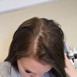Lice Clinics of America - St. Charles - She's checked me and removed them from my daughter so grateful for the peace of mind.
