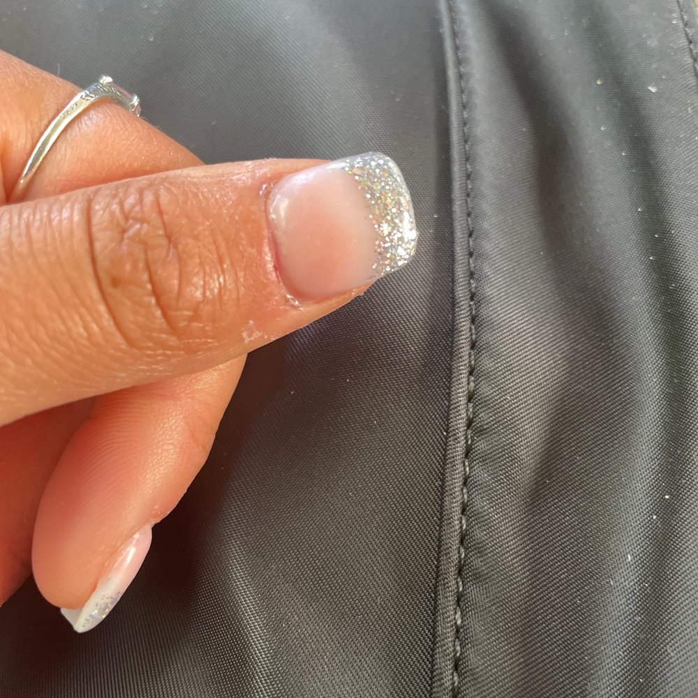 If you zoom in you can see the small particle of hair and my cuticle which was injured.