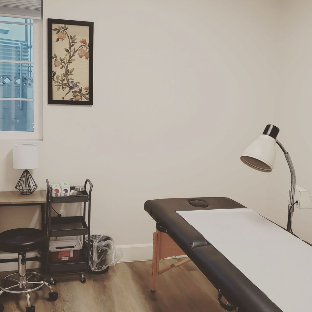 MINT ACUPUNCTURE Updated April 2024 1720 W Ball Rd, Anaheim