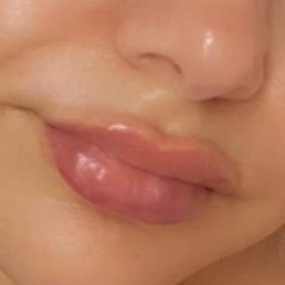 Refill from another place. So soft no visible bumps. - MM Aesthetics in Brooklyn Refill from another place. So soft no visible bumps. - MM Aesthetics in Brooklyn