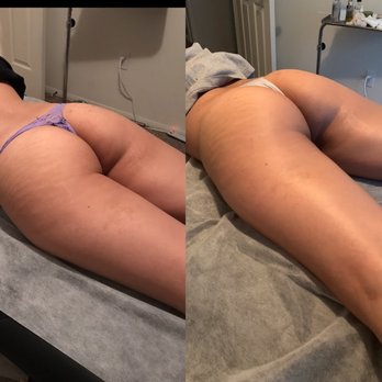 Las Vegas Sculpt - Skin Care Near Me - Las Vegas, Nevada Las Vegas Sculpt - Skin Care Near Me - Las Vegas, Nevada