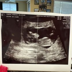 Advanced Fertility Care - Glendale - & this is our little girl who is due in January