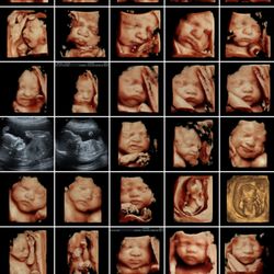 Life’s First Portrait Ultrasound Studio