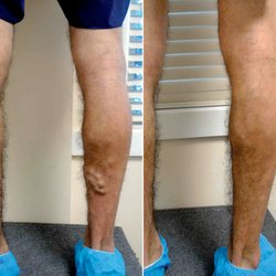 Vena Vein Clinic - Sherman oaks