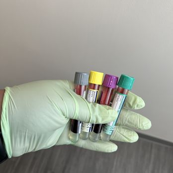 AlleCare Lab - One stick and go - Laboratory Testing Near Me AlleCare Lab - One stick and go - Laboratory Testing Near Me