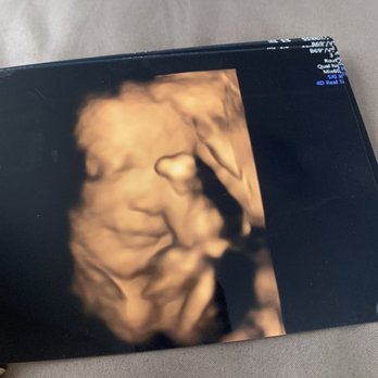 Babes & Bellies - Ultrasound Imaging Centers Near Me - Long Beach, California