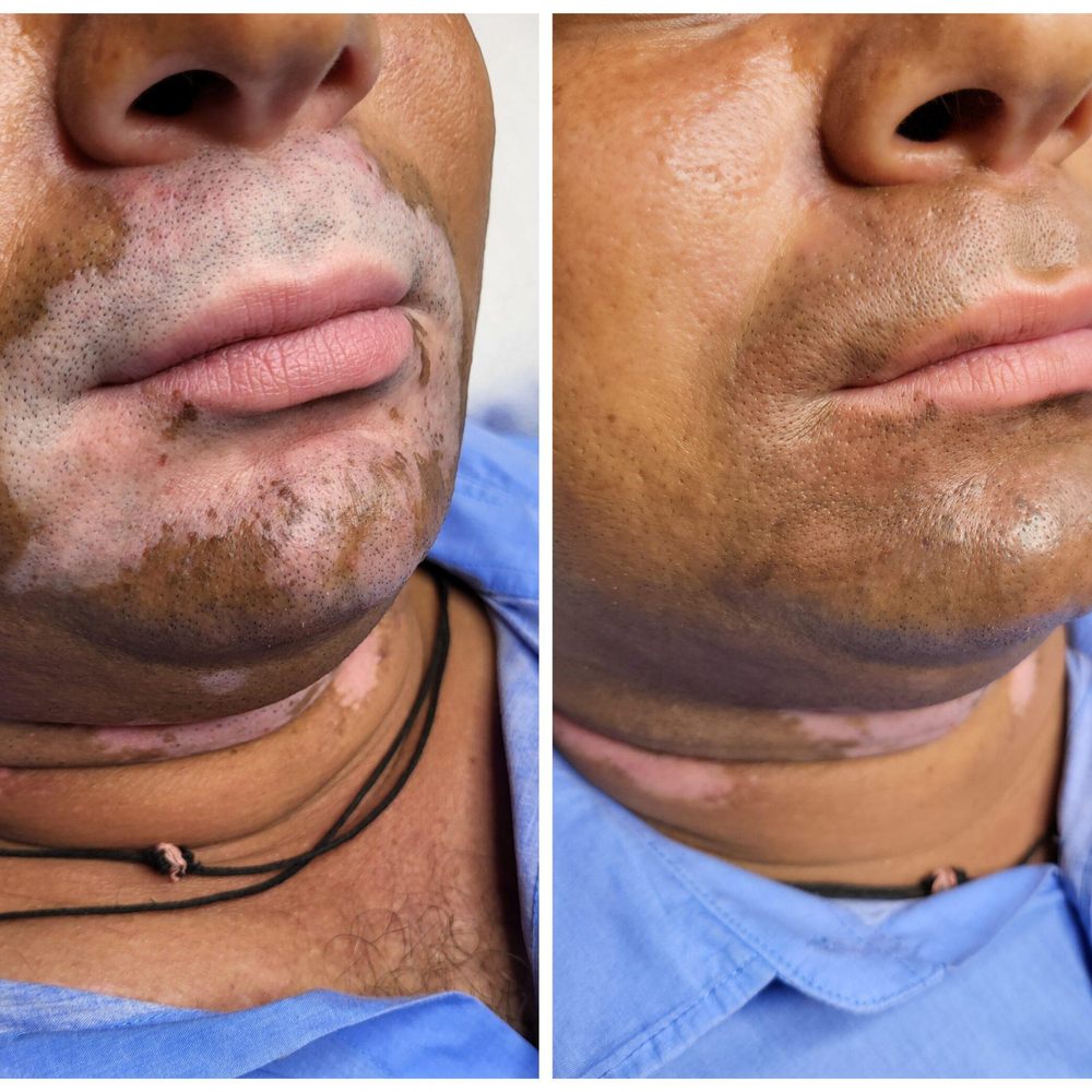 TOP 10 BEST Scalp Micropigmentation (Smp) in Fairfield, CA - Updated 2026 -  Yelp