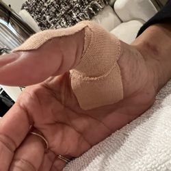 Lisa Savant Adams - Kinesiotape - trigger thumb