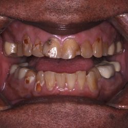 Universal Dentistry