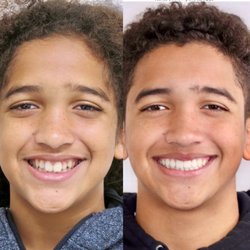 Orthodontics LA