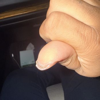KD Galaxy Nails And Spa - Glue from applying GelX incorrectly - Nail Salons Near Me - Mission Hills, California KD Galaxy Nails And Spa - Glue from applying GelX incorrectly - Nail Salons Near Me - Mission Hills, California