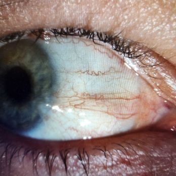 Franz Michel, MD - Ophthalmologists Near Me - Oxnard, California