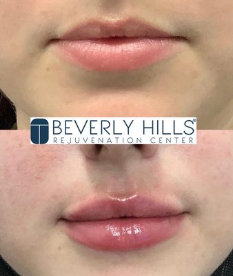 Beverly Hills Rejuvenation Center Westlake Village by null