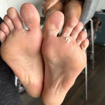 Posh Nails - This is AFTER the pedicure . Forced to pay for a service that was not adequately provided. - Nail Salons Near Me - Manhattan Beach, California