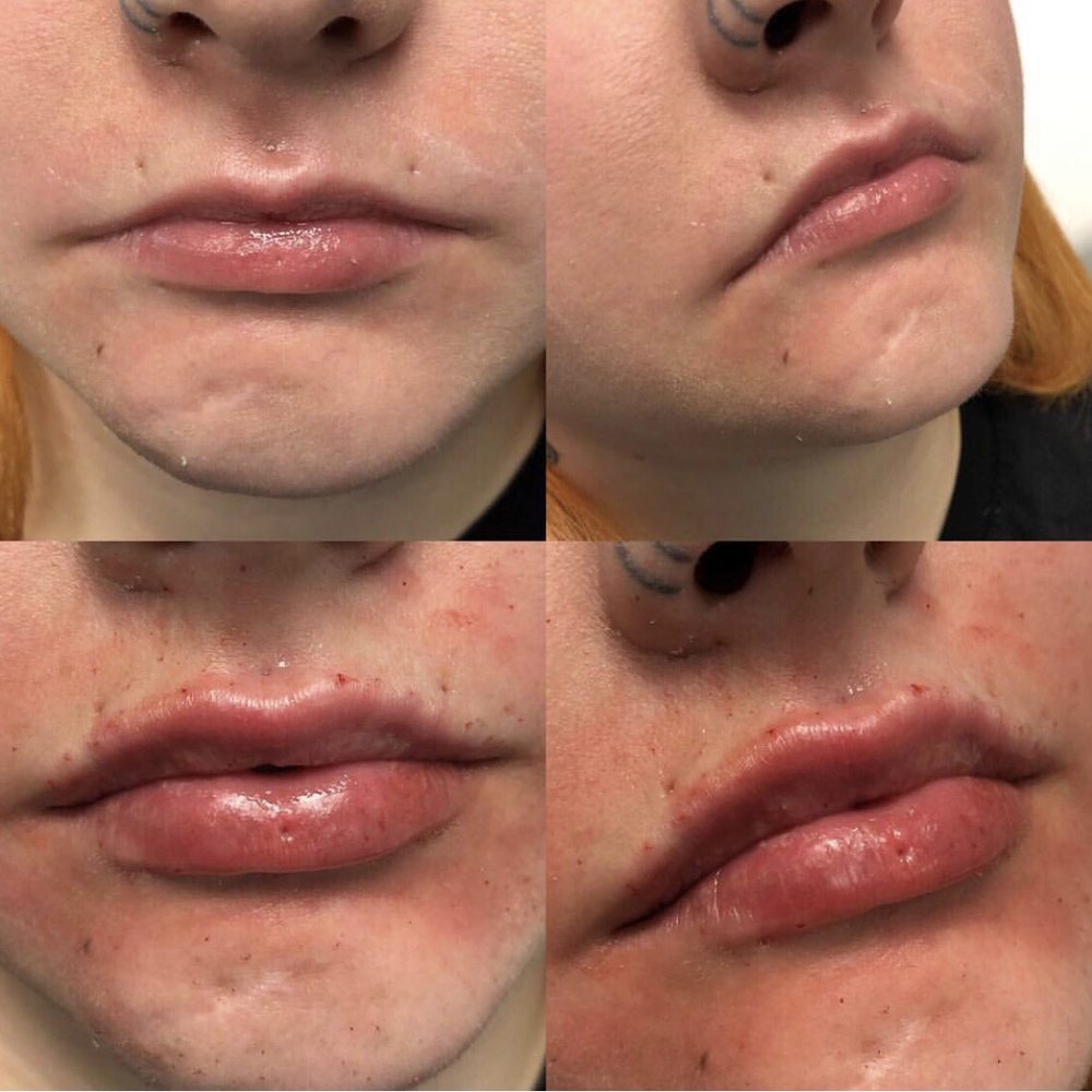 Lips