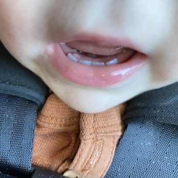 Davis Pediatric Dentistry - Pediatric Dentists Near Me - Encinitas, California Davis Pediatric Dentistry - Pediatric Dentists Near Me - Encinitas, California