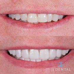 JJ Dental