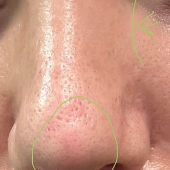 Dr Jay Calvert Plastic Surgery - Cosmetic Surgeons Near Me - Newport Beach, California Dr Jay Calvert Plastic Surgery - Cosmetic Surgeons Near Me - Newport Beach, California