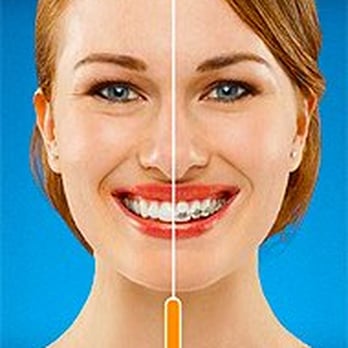 Liberty Orthodontic Centre - Dr. Arun Rajasekaran - Invisalign is the ultimate esthetic option for adults who do not want to wear braces. - Orthodontists Near Me - Markham, Ontario Liberty Orthodontic Centre - Dr. Arun Rajasekaran - Invisalign is the ultimate esthetic option for adults who do not want to wear braces. - Orthodontists Near Me - Markham, Ontario