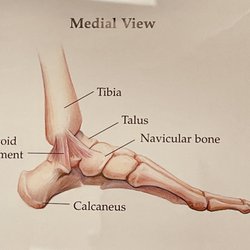 Jeremy Mangion, MD - Skeletal diagram medial view.