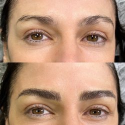 Nano blading immediately before and after