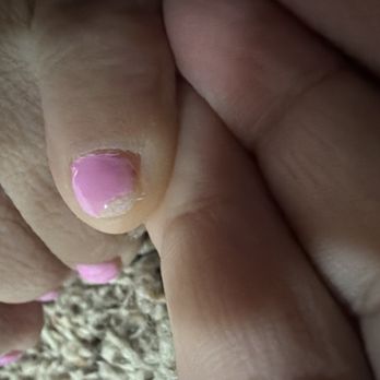 Phoenix Nails & Spa - The nail is peeled off after 4 days - Nail Salons Near Me - Goodyear, Arizona