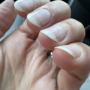 Nails & Spa Salon - Midtown - Nail damage - Nail Technicians Near Me - New York, New York Nails & Spa Salon - Midtown - Nail damage - Nail Technicians Near Me - New York, New York