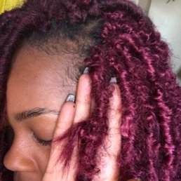 The rips on the hair , there's 4 of these in my head like this. The rips on the hair , there's 4 of these in my head like this.