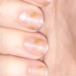 Expo Nails - Still in recovery