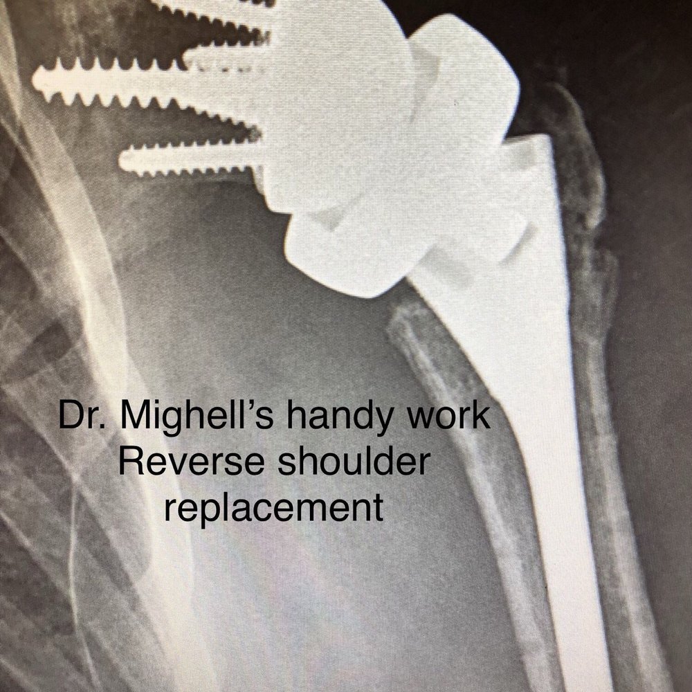 Mark Mighell MD - Orthopedists Near Me - Tampa, Florida