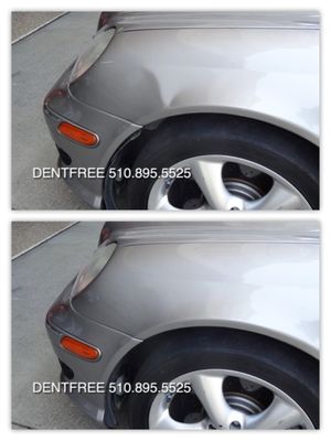 Photo of DentFree - San Leandro, CA, US.