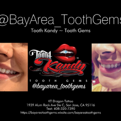 Bay Area Tooth Gems