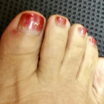 Nails La Vie - big toe infection one week later - Nail Salons Near Me - Honolulu, Hawaii